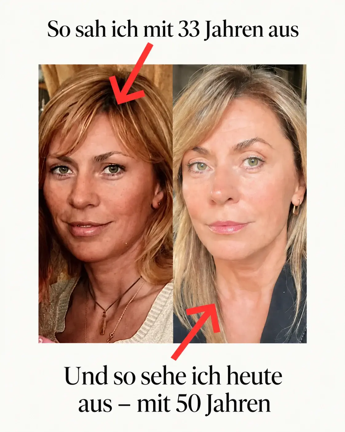 Ieva Nelke zeigt den Vergleich ihrer Hautgesundheit nach 15 Jahren Selbstmassage.